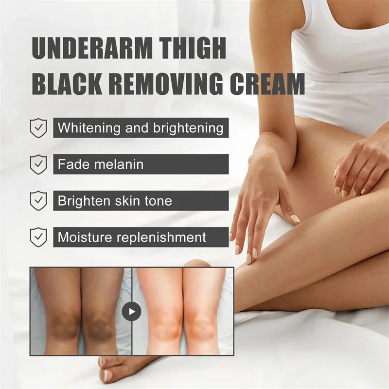 Whitening Cream Private Parts